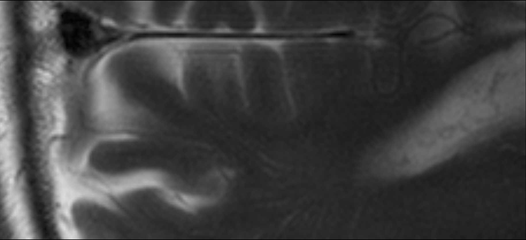 MRT-Bild / MRI image